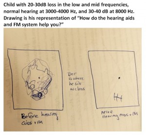 child's drawing of HA-FM use